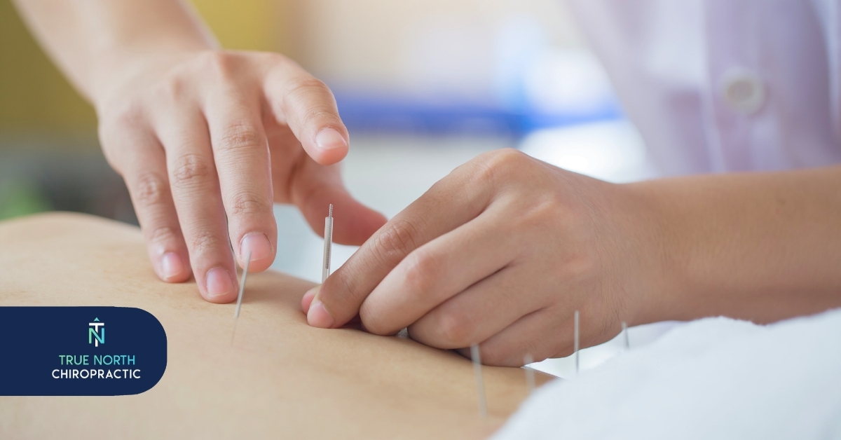 Chiropractic Care vs. Traditional Medicine | True North Chiropractic