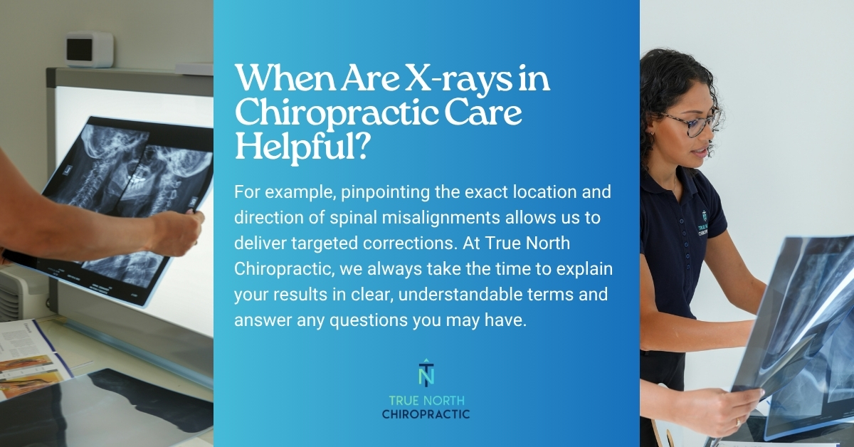 Benefits of X-Rays in Chiropractic Care | True North Chiro South Morang