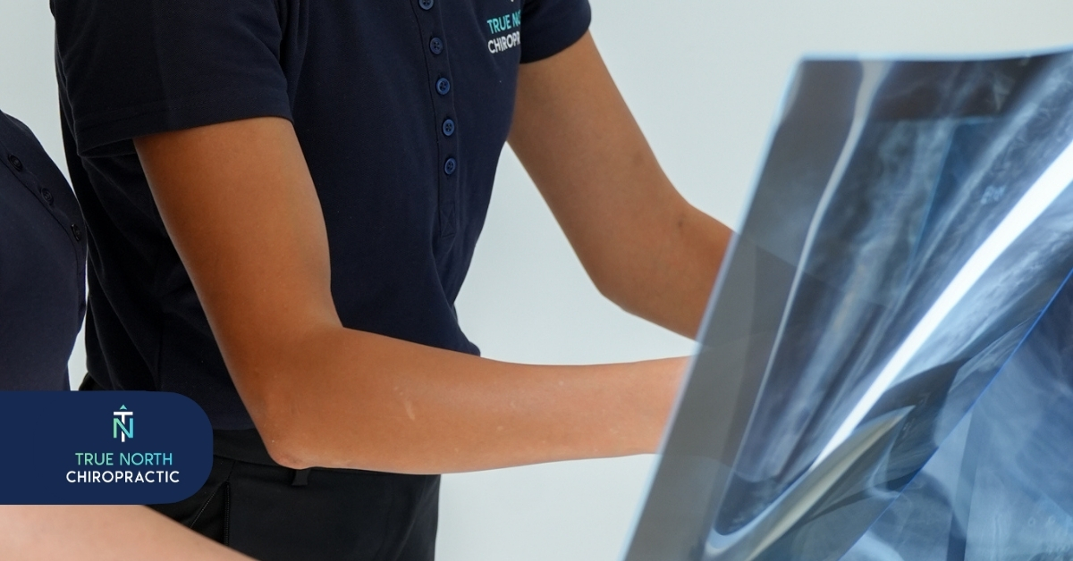 South Morang Chiropractic Imaging | True North Chiropractic