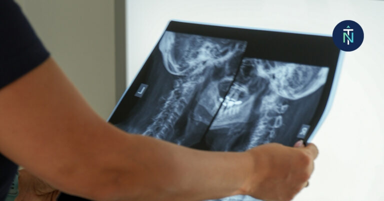 South Morang Chiropractic Assessment Tools | True North Chiropractic